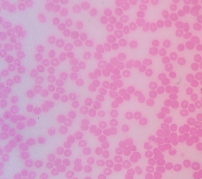 Microscope image of pink-stained circular red blood cells on a light background.