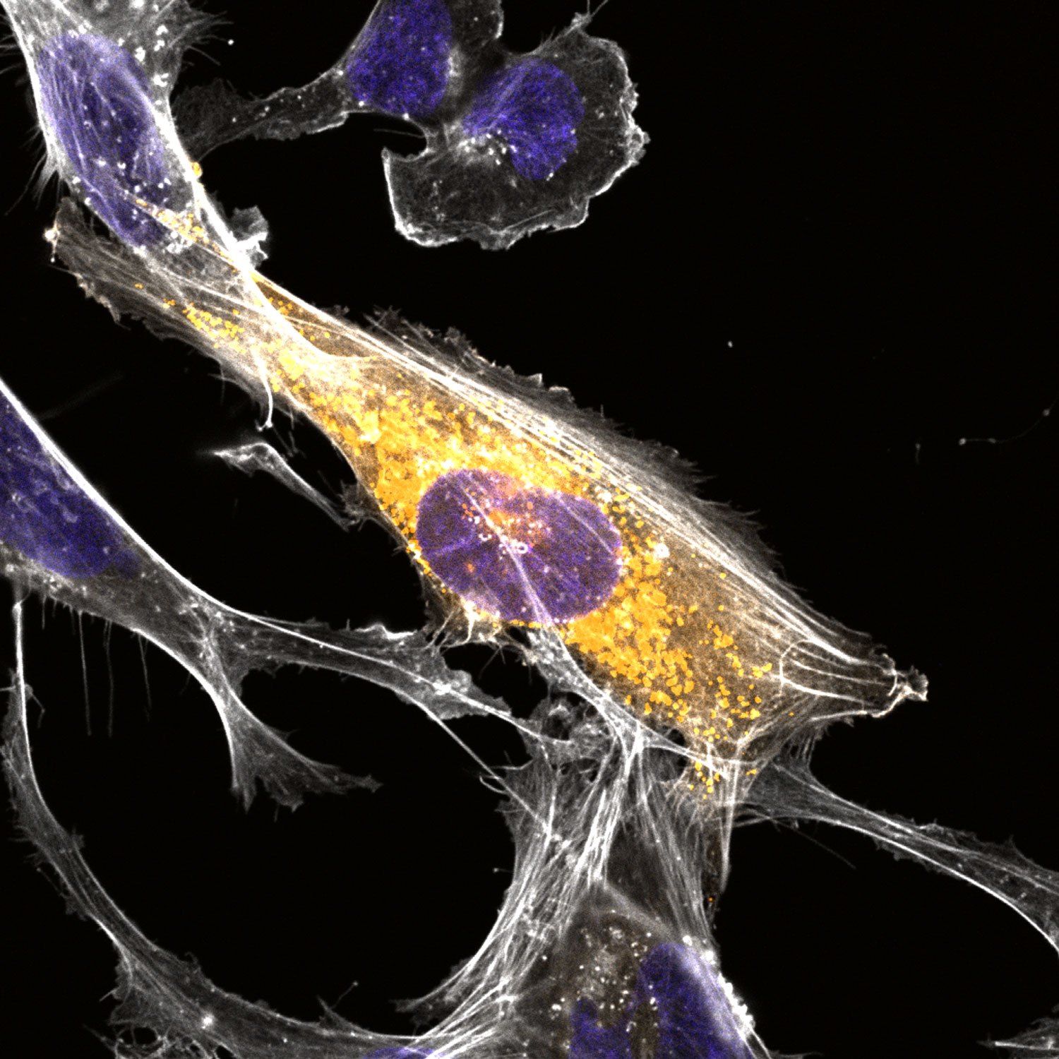 Fluorescence microscopy image of a microglial cell with orange protein around a blue nucleus.