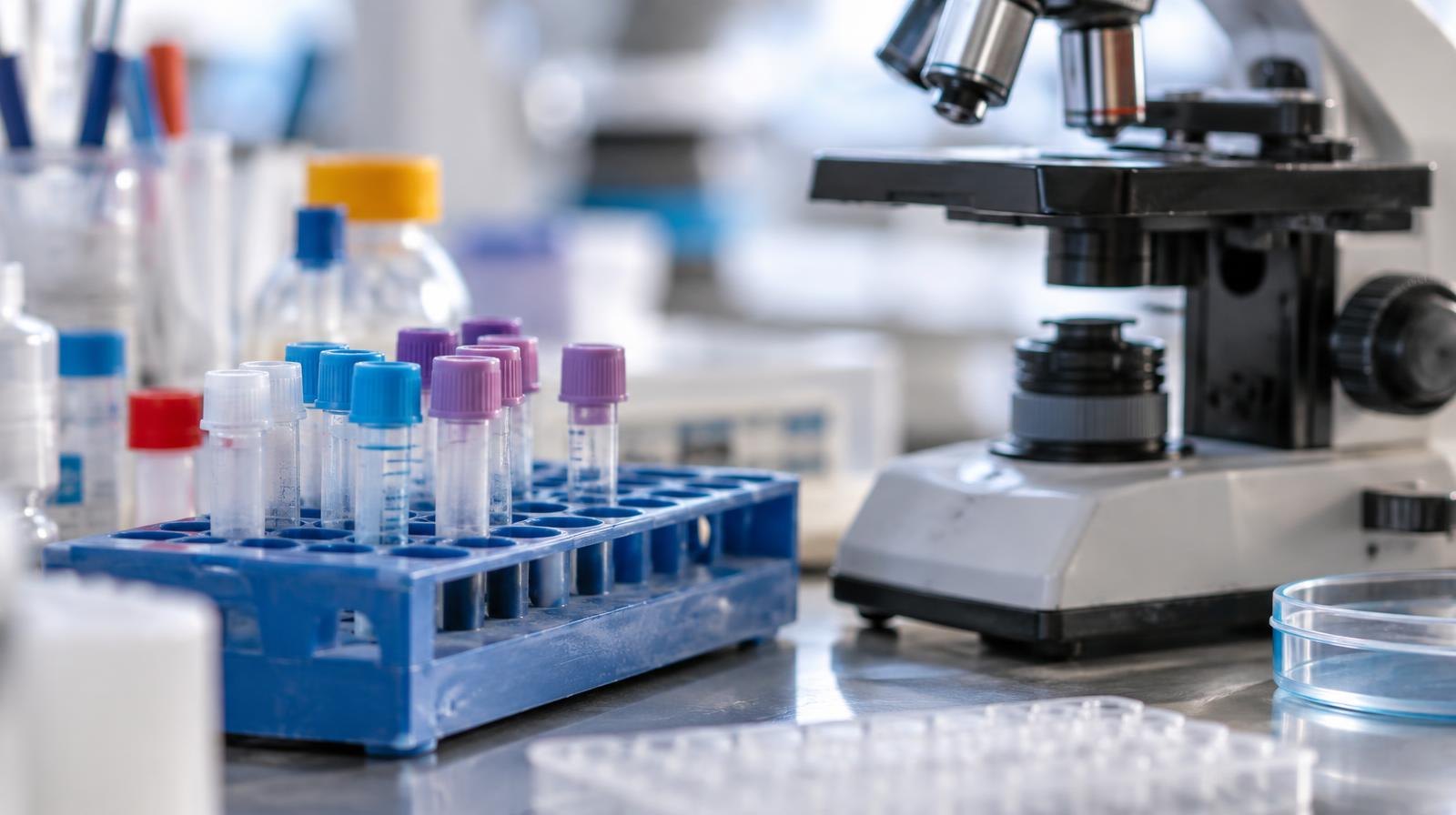 Small vials in a test tube rack beside a microscope on a laboratory bench.