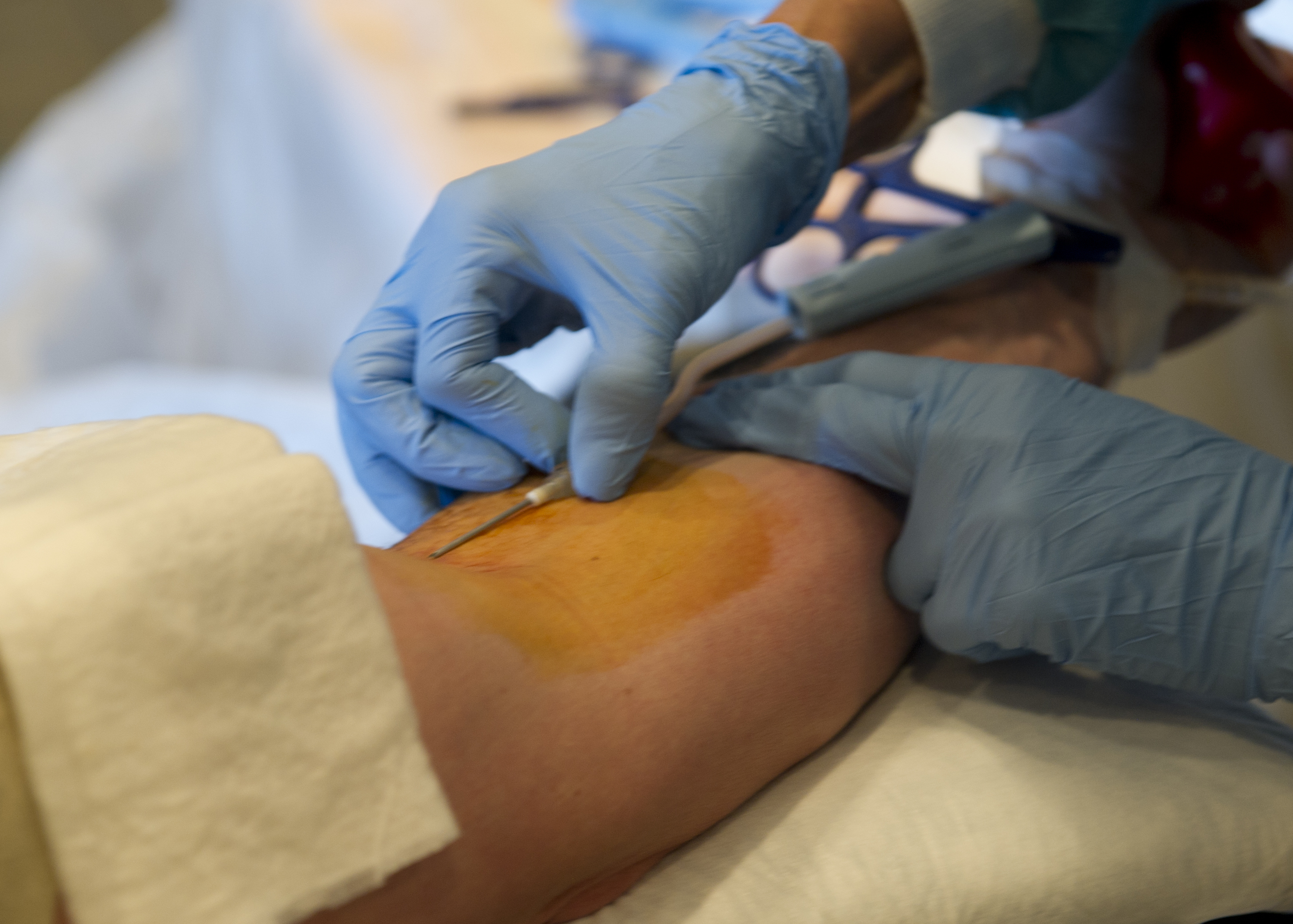 Gloved hands inserting a needle into a donor's arm during a blood draw.