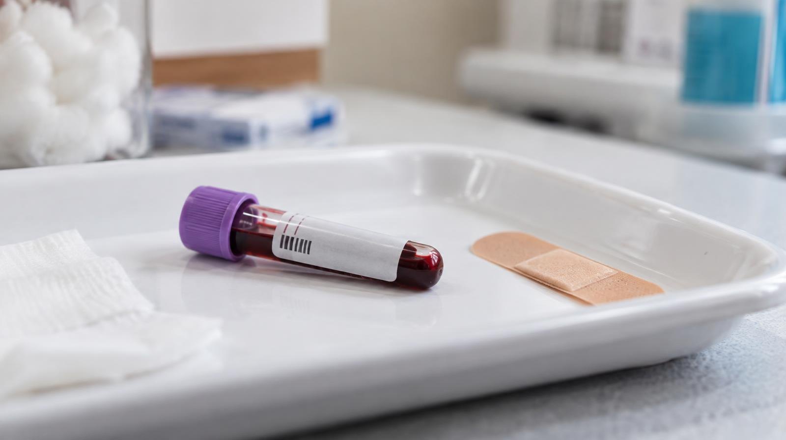 A small glass blood vial on a white medical tray beside a bandage strip.