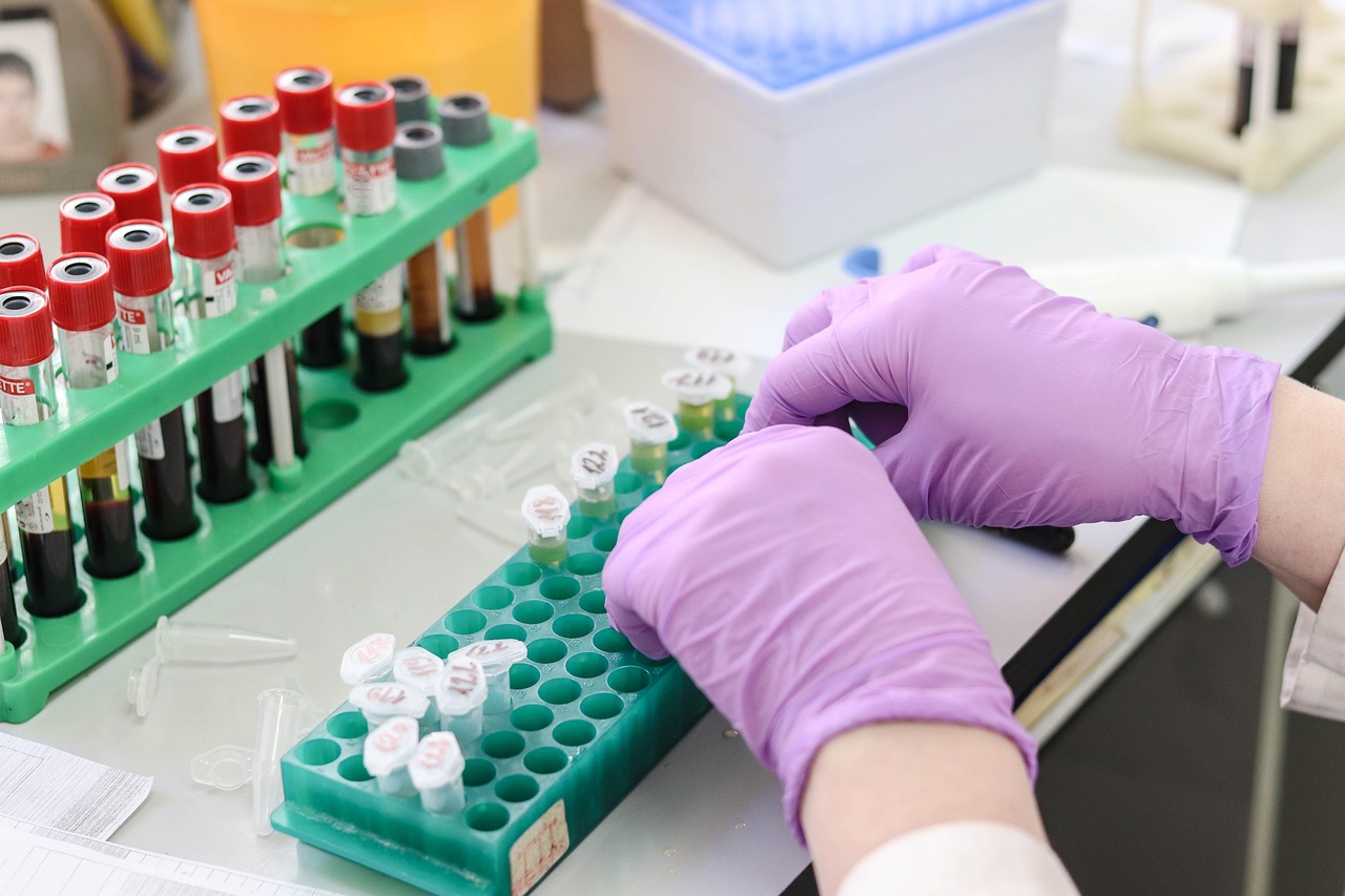 Researcher wearing gloves handles laboratory samples at a workbench.
