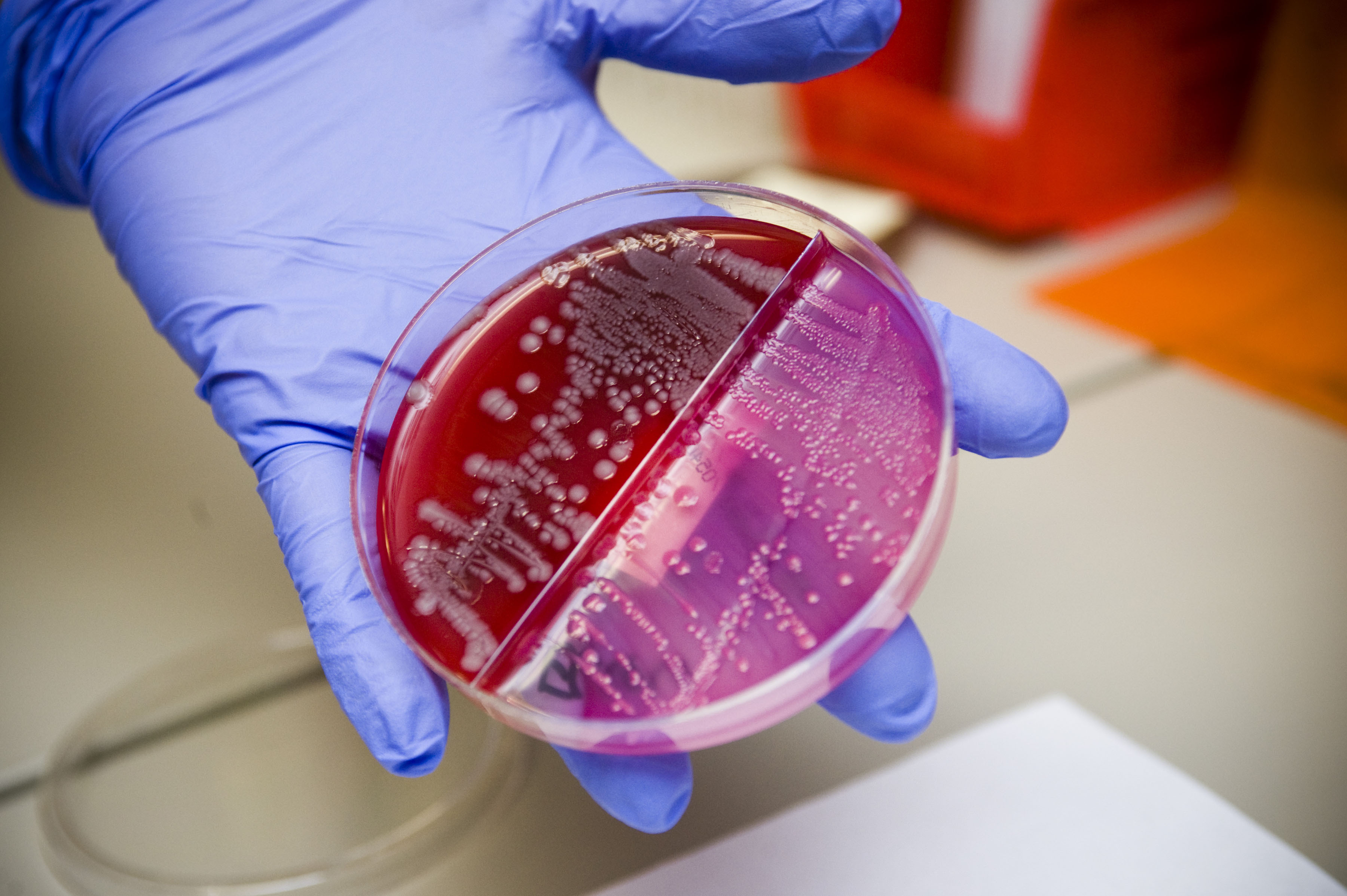 Gloved hand holding a Petri dish with visible E. coli bacterial colonies on red agar.