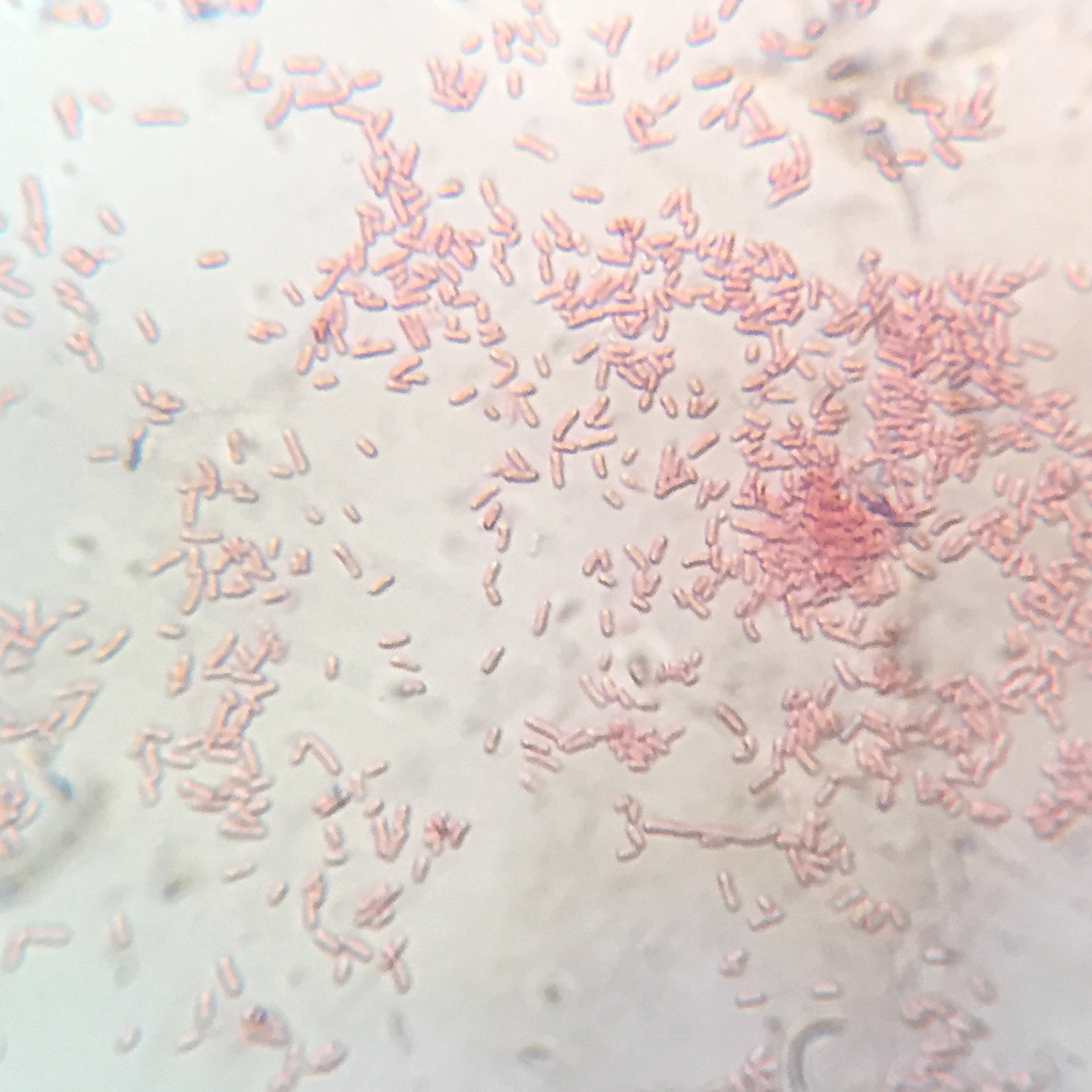 Pink rod-shaped bacteria clustered on a pale microscope slide.