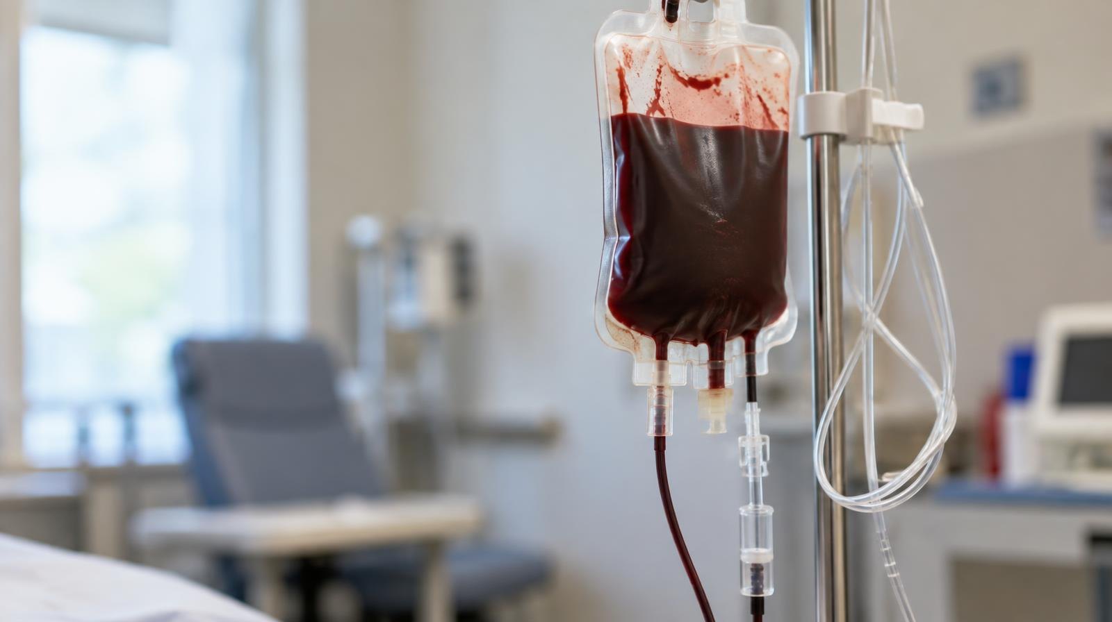 A filled blood donation bag hanging from an IV stand with clear medical tubing.