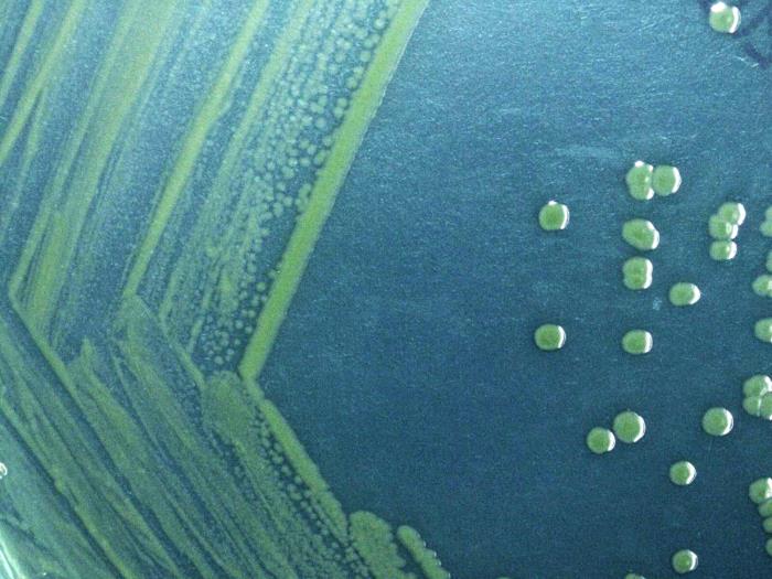 Green bacterial colonies growing on blue-green agar in a petri dish.