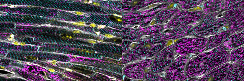 Salk study finds embryonic stress shields hearts from chemo damage