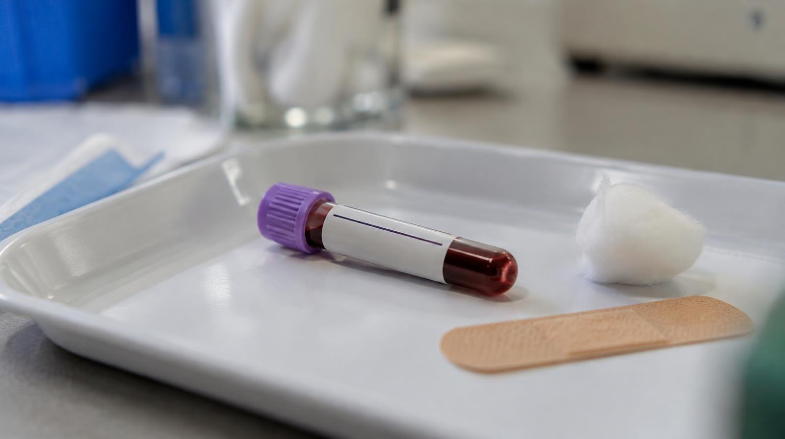 A small glass blood vial on a white medical tray beside a cotton swab and bandage.