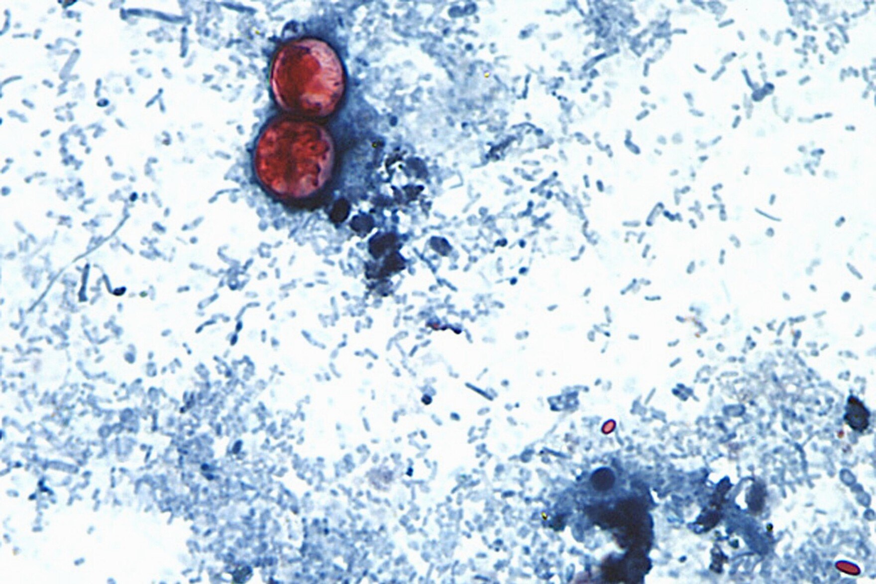 Microscope image showing two red-stained spherical oocysts against a blue cellular background.
