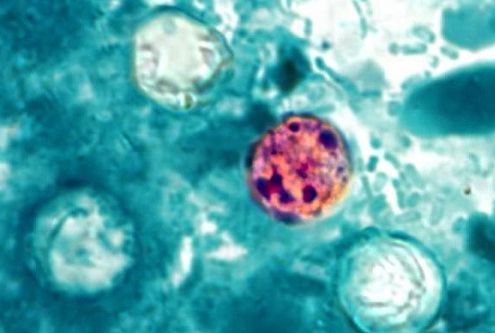 cyclospora cells