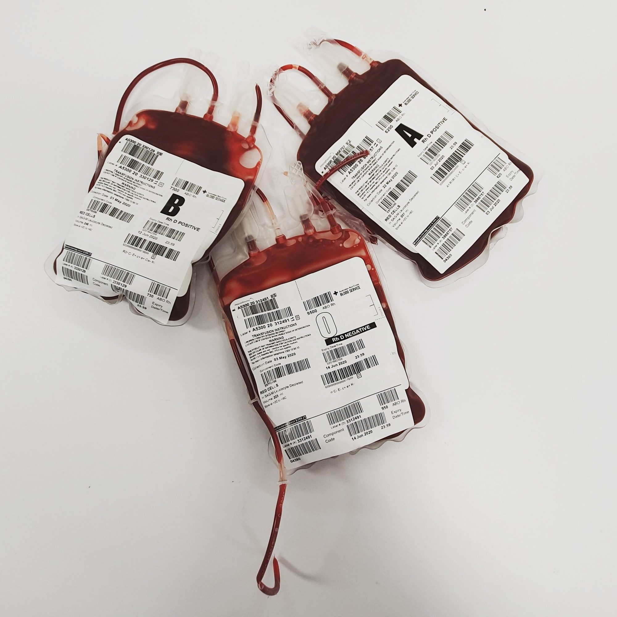 Blood bags labeled A, B, and O for donation and transfusion use.