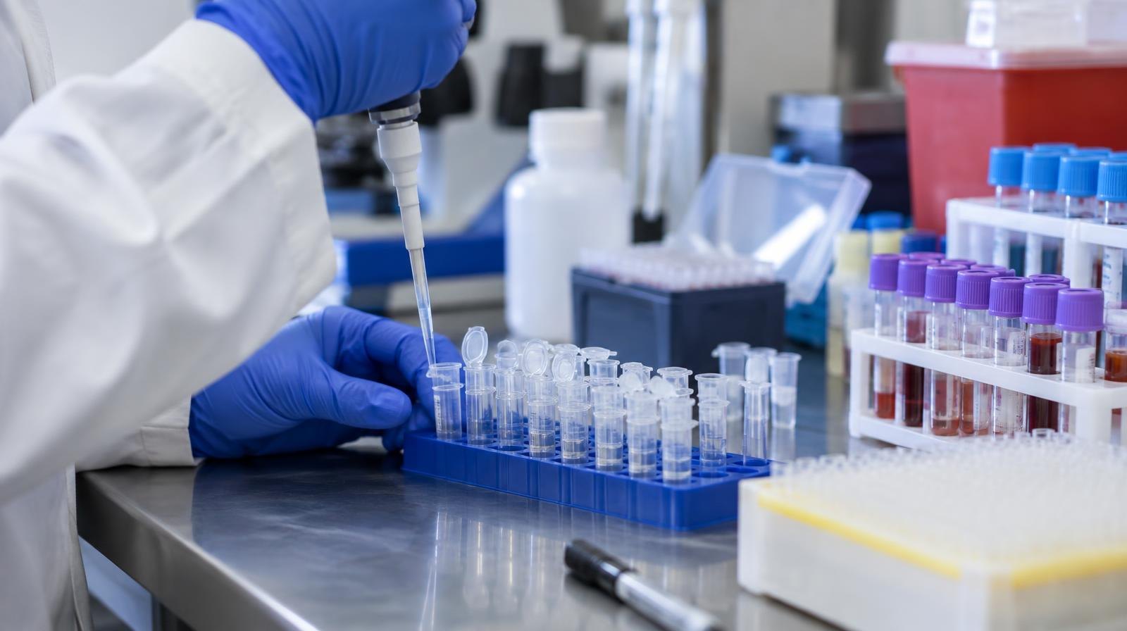 Test tubes, pipettes, and sample vials on a laboratory workbench under bright clinical lighting.