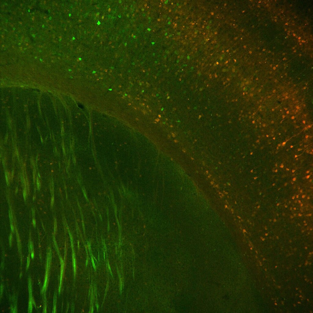 Fluorescence microscopy image showing green and orange labeled neurons in mouse brain tissue.