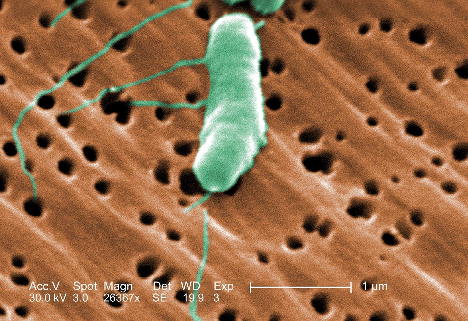 Colorized electron microscope image of a single green Vibrio vulnificus bacterium with flagella.