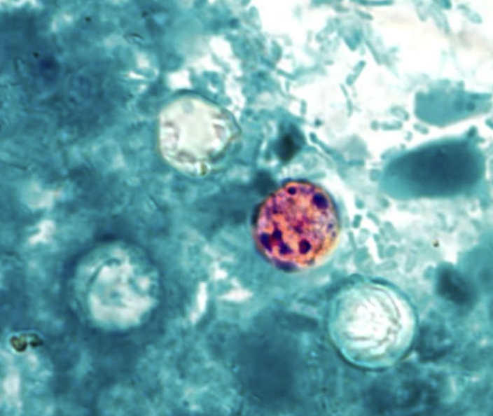 A Cyclospora cayetanensis oocyst, the parasite responsible for cyclosporiasis, seen under a microscope.