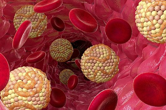 High cholesterol levels. Computer artwork balls of cholesterol in a blood vessel. Cholesterol is a lipid, a fat-like substance. High blood levels of LDL (low-density lipoprotein) cholesterol compared to HDL (high-density lipoprotein) cholesterol are thought to raise the risk of atherosclerosis, the build-up of fatty deposits on artery walls. This is a major cause of heart attack and stroke.
