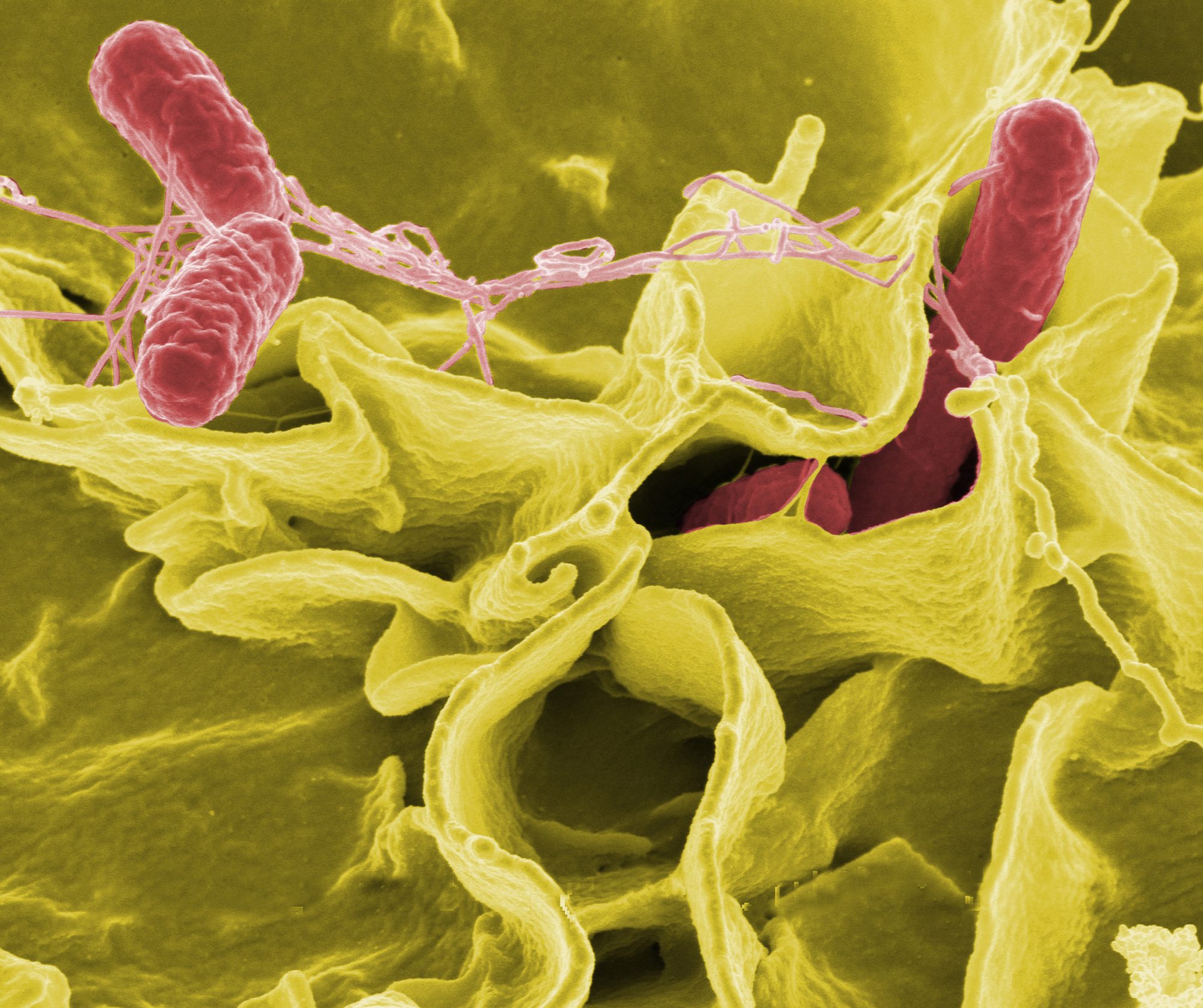 Color-enhanced scanning electron micrograph showing Salmonella Typhimurium (red) invading cultured human cells Credit: Rocky Mountain Laboratories, NIAID, NIH All the images, except specified ones from the World Health Organization (WHO), are in the public domain. For the public domain images, there is no copyright, no permission required, and no charge for their use.
