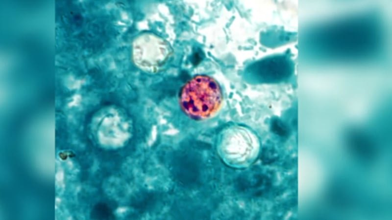 Manatee, Sarasota counties report four cyclosporiasis cases as national outbreak grows