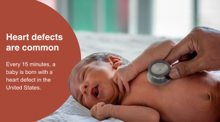CDC graphic reading "Heart defects are common — Every 15 minutes, a baby is born with a heart defect in the United States," alongside a photo of a doctor listening to a newborn's heartbeat with a stethoscope.