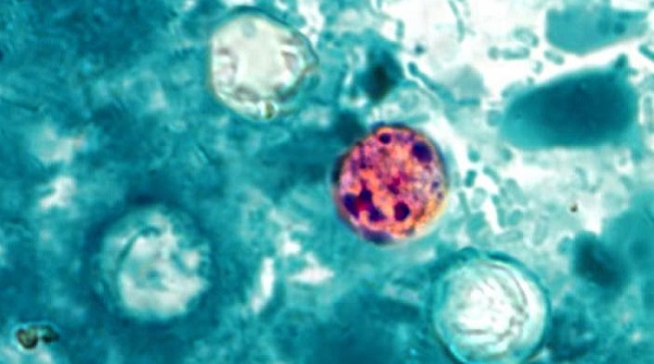 cyclospora cells