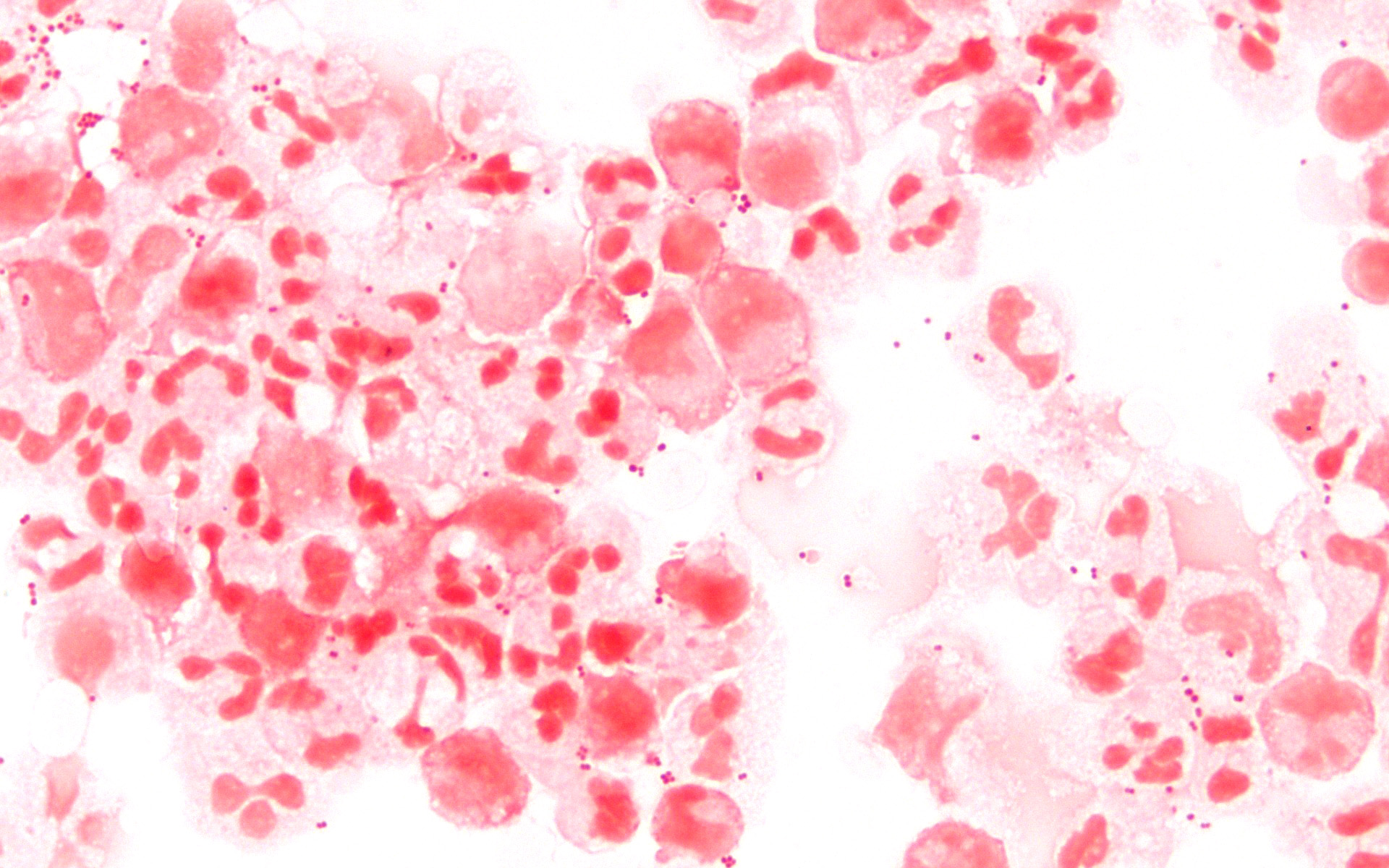 Microscope image showing pink paired bacteria against a white background.