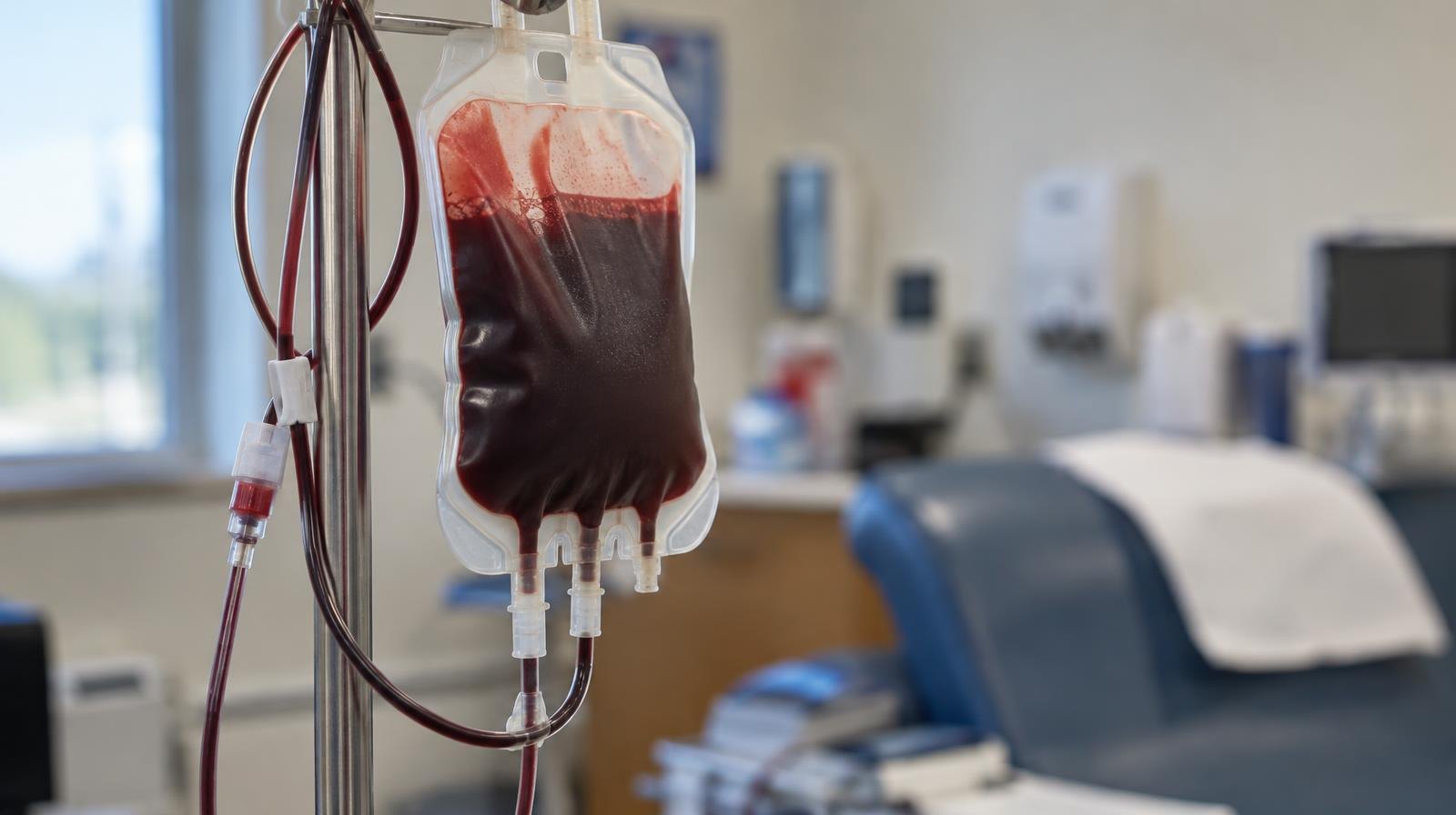 A sealed blood bag filled with dark red blood hanging on a medical IV stand.
